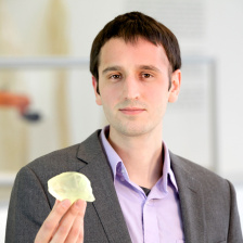 Steven Keating holding up a 3D printed copy of his brain tumor