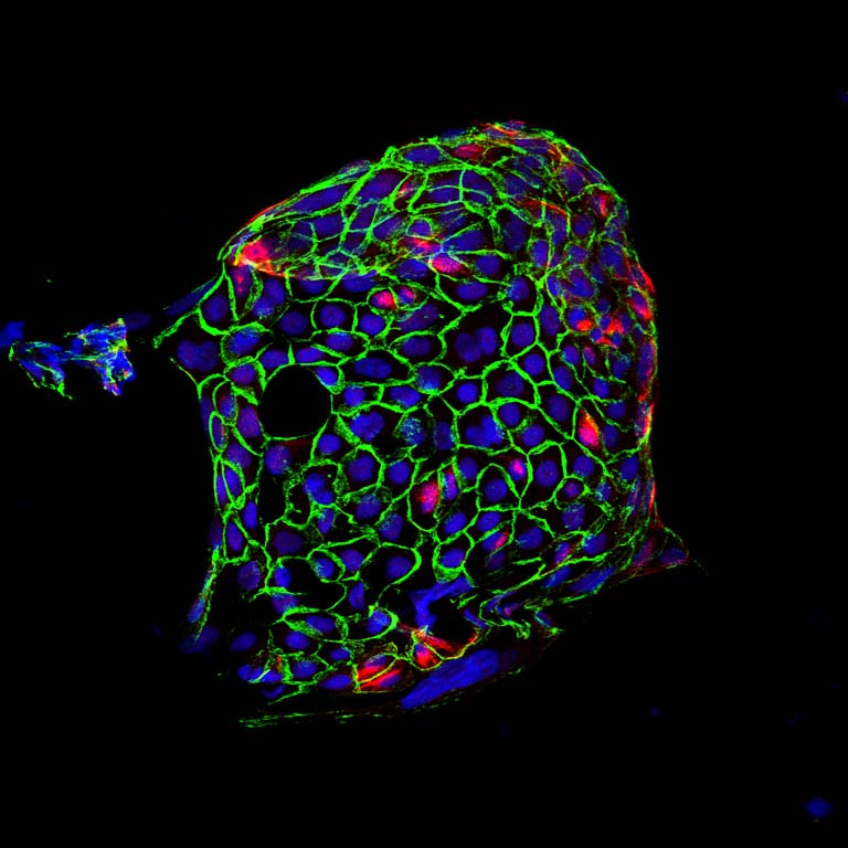 Tumor organoid with red, green and blue fluorescent structures