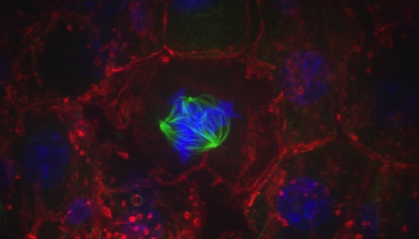 dividing cell in blue and green with red background