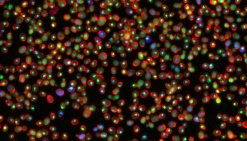yeast cells stained with fluorescent proteins to show DNA damage