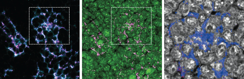 Three images of antigen localized to cells, the leftmost in cyan and magenta circles against a black background, the center a field of green spheres punctuated with magenta dots, and the rightmost a field of grey spheres lined in blue.