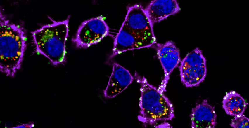 microscopic image of ovarian cells dotted with nanoparticles