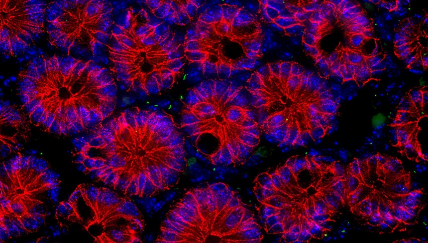 intestinal epithelial cells stained for their ability to generate primary cilia