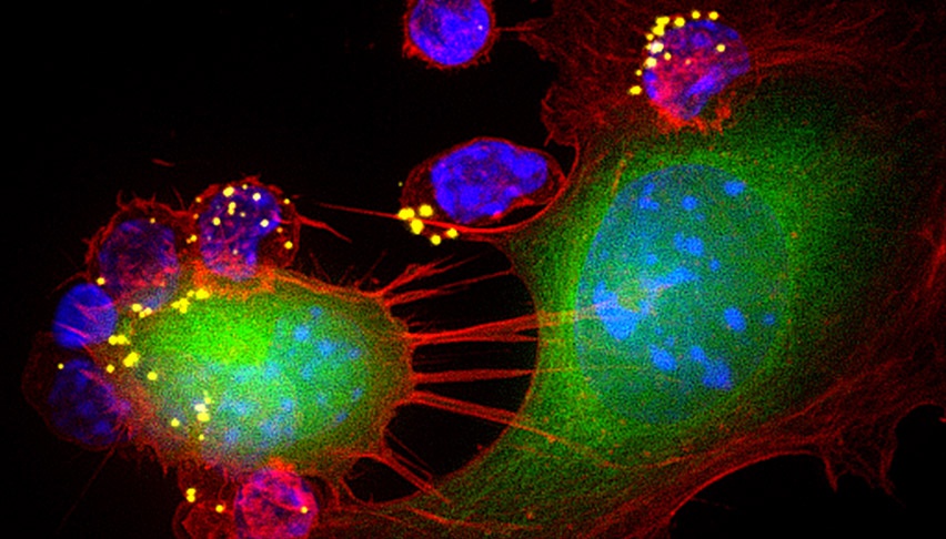 microscopic image of T cells carrying nanoparticles to tumor cells