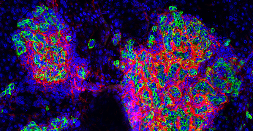 two clouds of vibrant, multicolored cells against a dark background