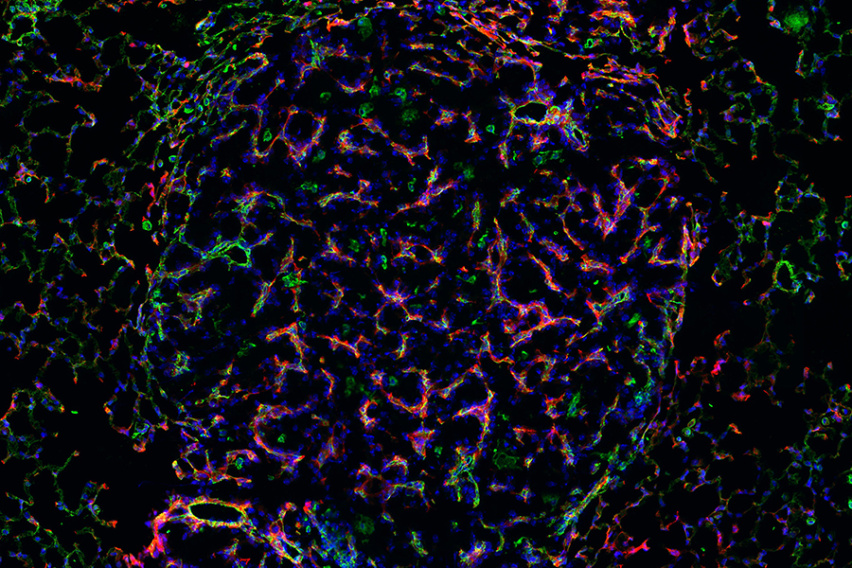 probes (red) localizing to blood vessels (green) within lung cancer tumors