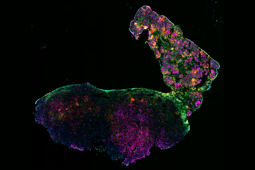 immunofluorescent image of a tumor