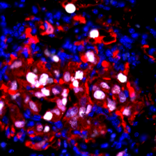 Micrograph with a cluster of red and some white spots amongst many blue spots.