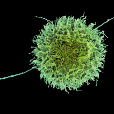 A human natural killer cell