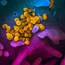 coronavirus in yellow, pink, aqua