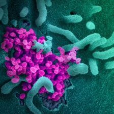 scanning electron microscope image of SARS-CoV-2 virus