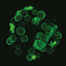 spherical organoids in green fluorescence