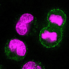 microscopic image of cells with DNA in magenta and lysosomal markers on surface in green