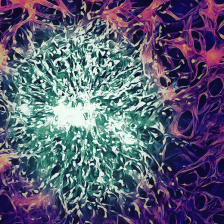 a cluster of tumor cells in green, surrounded by endothelial cells in purple