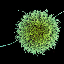 Micograph of a natural killer cell, a fuzzy sphere with a few long, spindly protrusions
