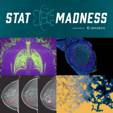 four panel view of lungs, pancreatic tumor, visualization of nanoparticle structure, and mammograms, with a STAT Madness header