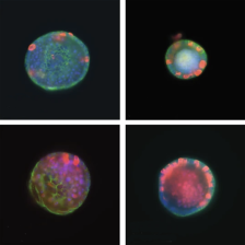 4 organoids showing different patterns of fluorescent staining
