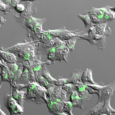 tumor cells expressing antigens (green)