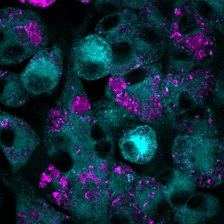 confocal microscopy image showing round macrophages treated with MTX (cyan) that have eaten bacteria (magenta)