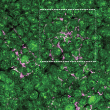 A dense field of green follicular dendritic cells with magenta antigen filled in between.
