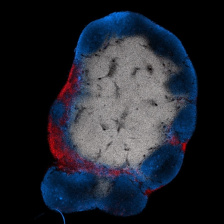a lymph node with an outer ring of red and blue, indicating the presence of T and B cells respectively