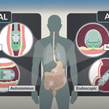 Various microjet devices showing radial and axial delivery methods for both endoscopic and autonomous devices.