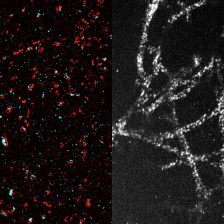 High-resolution images of synapses and microtubules 