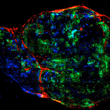 An image showing poor distribution of an antibody through a tumor grown in a mouse.  
