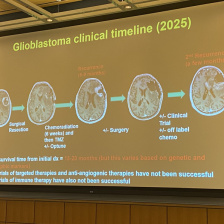 Powerpoint slide with text - Gliobastoma clinical timeline 2025