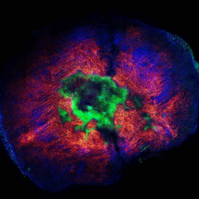 immune cell - green, red, blue and purple blobs on a background 