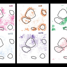 Scientific illustration of cHL (classic Hodgkin Lymphoma) tissue