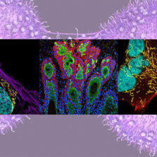 Three screens of cancer cells