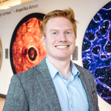 Photo of Matthew G. Jones, smiling for the camera, standing in front of a wall of colorful scientific images in the Koch Institute lobby.