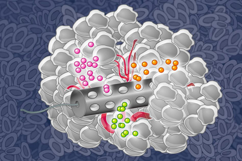 illustration of a tubular device with holes dispensing particles to a tumor