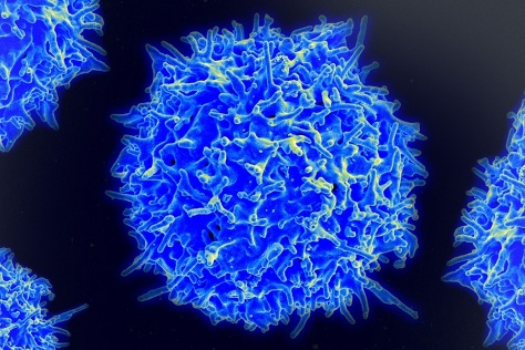 scanning electron micrograph of a T cell