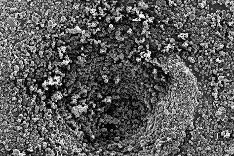 electron microscopy image of a drug-delivery system