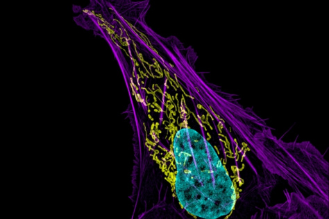 osteosarcoma cell with DNA in blue, mitochondria in yellow, and actin filaments in purple