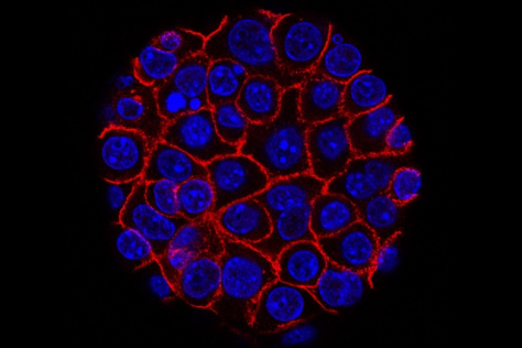 pancreatic cancer cells (nuclei in blue) growing as a sphere encased in membranes (red)