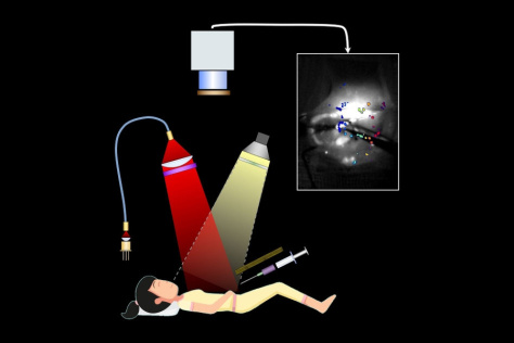 diagram of person undergoing surgery aided by imaging system