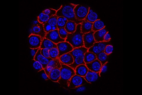 Pancreatic cancer cells (nuclei in blue) growing as a sphere encased in membranes (red)
