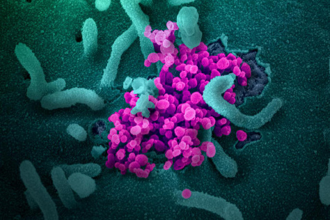 scanning electron microscope image of SARS-CoV-2 virus