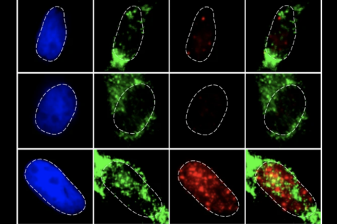 micrographs of cells showing effects of different genetic knockdowns