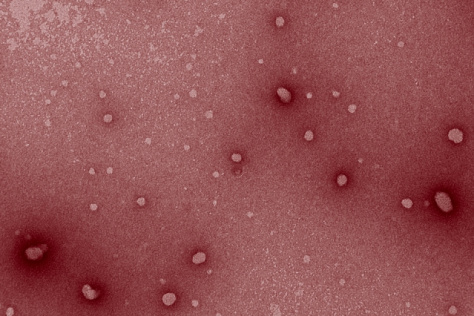 false colored electronmicroscope image of nanoparticles 