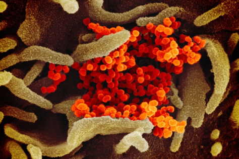 scanning electron microscope image of SARS-CoV-2 (orange)