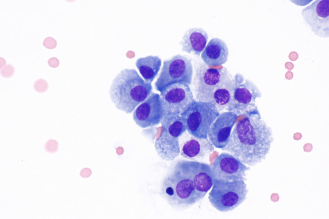 macrophages