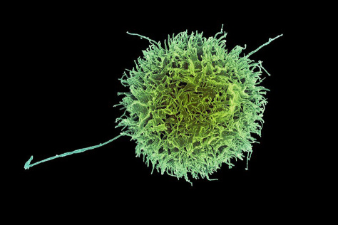 natural killer cell