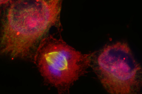 poly ADP ribose localized at mitotic spindles