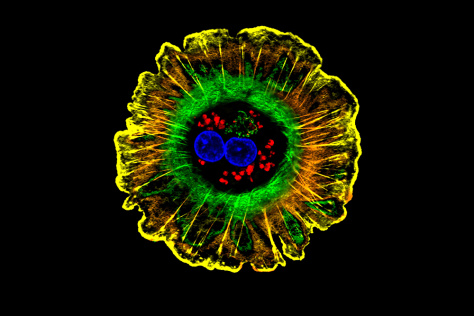 multicolored image of a hepatocyte (liver cell)