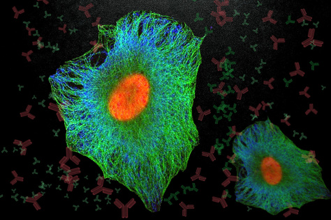 Bright green cells with web-like interiors and orange nuclei on a dark background of antibodies