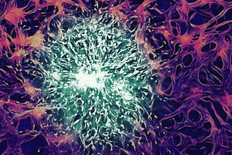 a cluster of tumor cells in green, surrounded by endothelial cells in purple